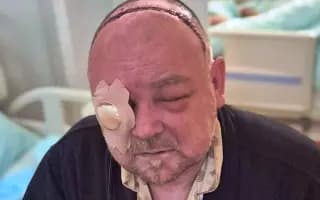 Pomohli jste Petrovi, který přišel o zrak